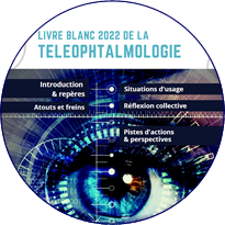 Elargissement prochain de la téléophtalmologie : quelle place pour les opticiens ?